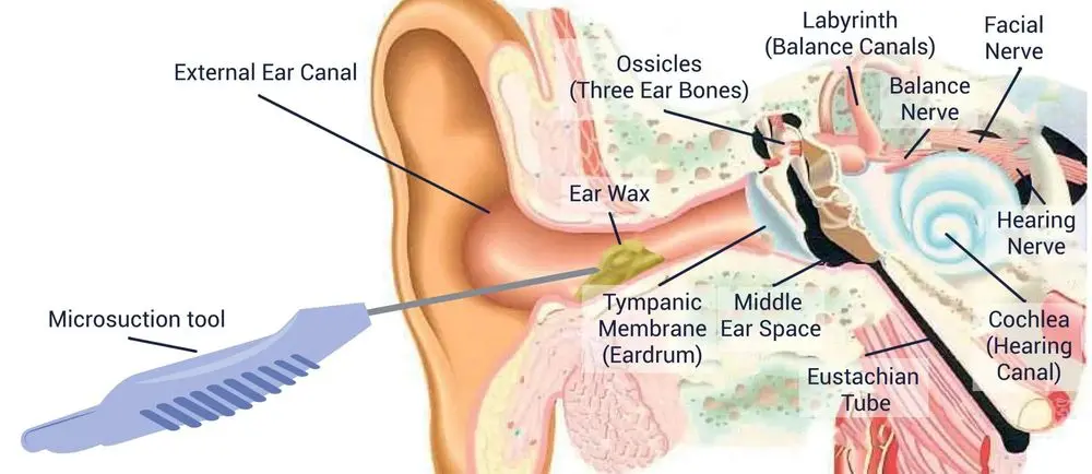 Ear Cleaning Canal